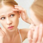 10-Natural-Acne-Remedies-That-Work-1.jpg